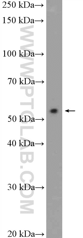 Western Blot (WB) analysis of MCF-7 cells using STK38 Polyclonal antibody (55335-1-AP)