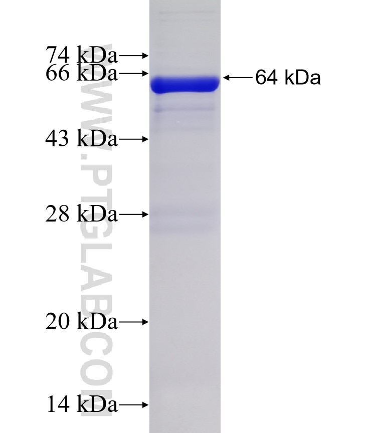 STK38 fusion protein Ag1559 SDS-PAGE