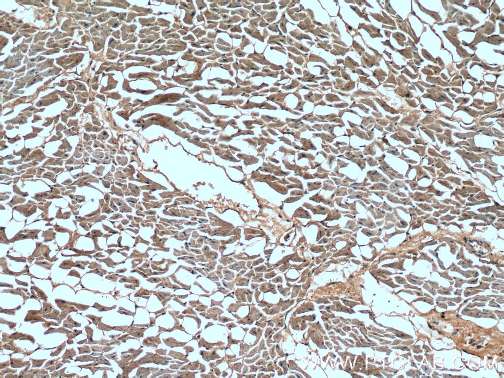 IHC staining of human heart using 12697-1-AP