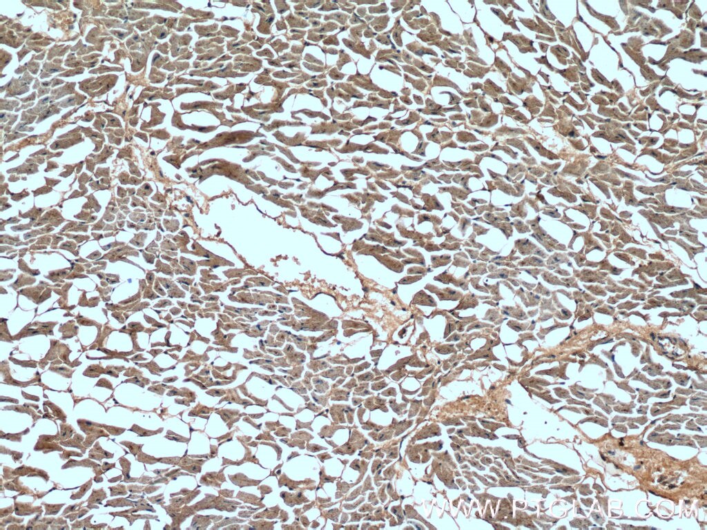 Immunohistochemistry (IHC) staining of human heart tissue using STK38L Polyclonal antibody (12697-1-AP)