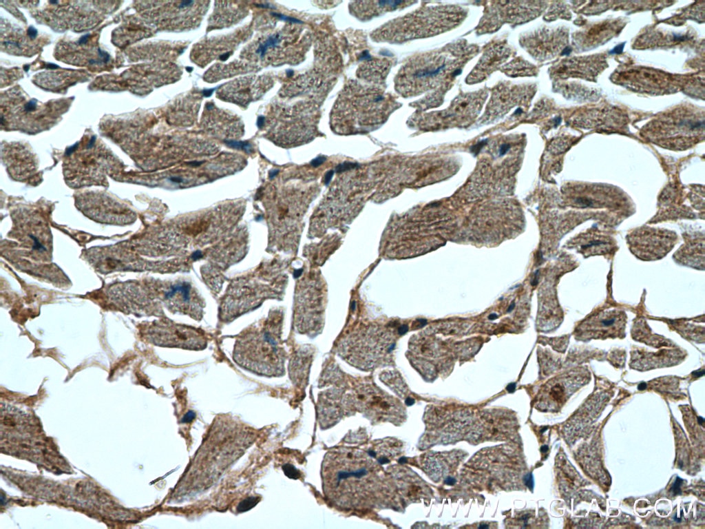 Immunohistochemistry (IHC) staining of human heart tissue using STK38L Polyclonal antibody (12697-1-AP)