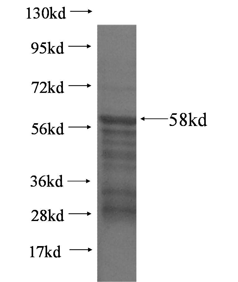 STK38L fusion protein Ag3413 SDS-PAGE
