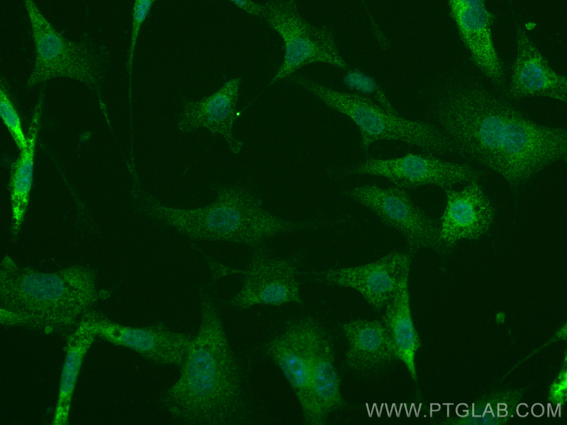 Immunofluorescence (IF) / fluorescent staining of NIH/3T3 cells using STK39 Recombinant antibody (83081-2-RR)