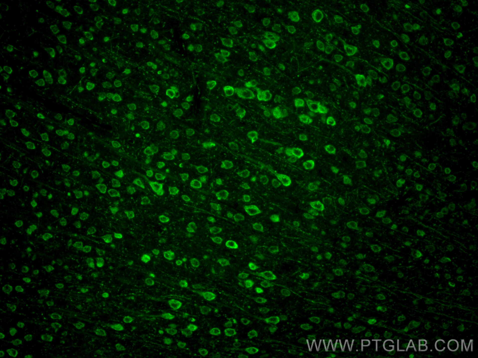 Immunofluorescence (IF) / fluorescent staining of mouse brain tissue using STK39 Recombinant antibody (83081-2-RR)