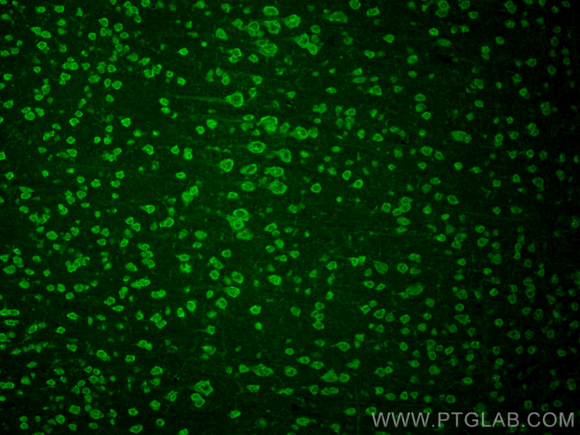 Immunofluorescence (IF) / fluorescent staining of mouse brain tissue using CoraLite® Plus 488-conjugated STK39 Recombinant an (CL488-83081-2)