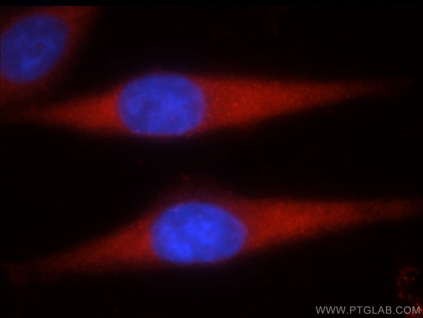 Immunofluorescence (IF) / fluorescent staining of HepG2 cells using MST1 Polyclonal antibody (22245-1-AP)