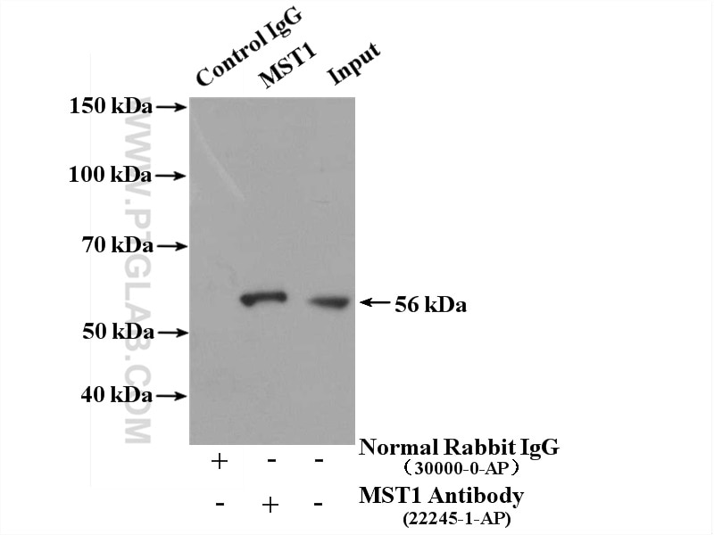 Immunoprecipitation (IP) experiment of HeLa cells using MST1 Polyclonal antibody (22245-1-AP)