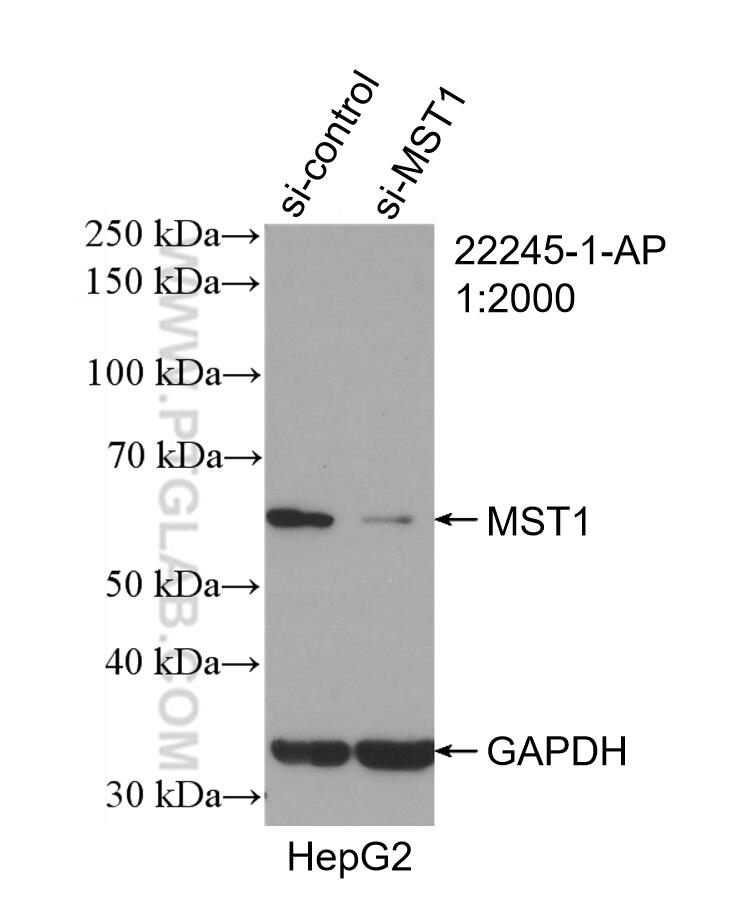 Western Blot (WB) analysis of HepG2 cells using MST1 Polyclonal antibody (22245-1-AP)