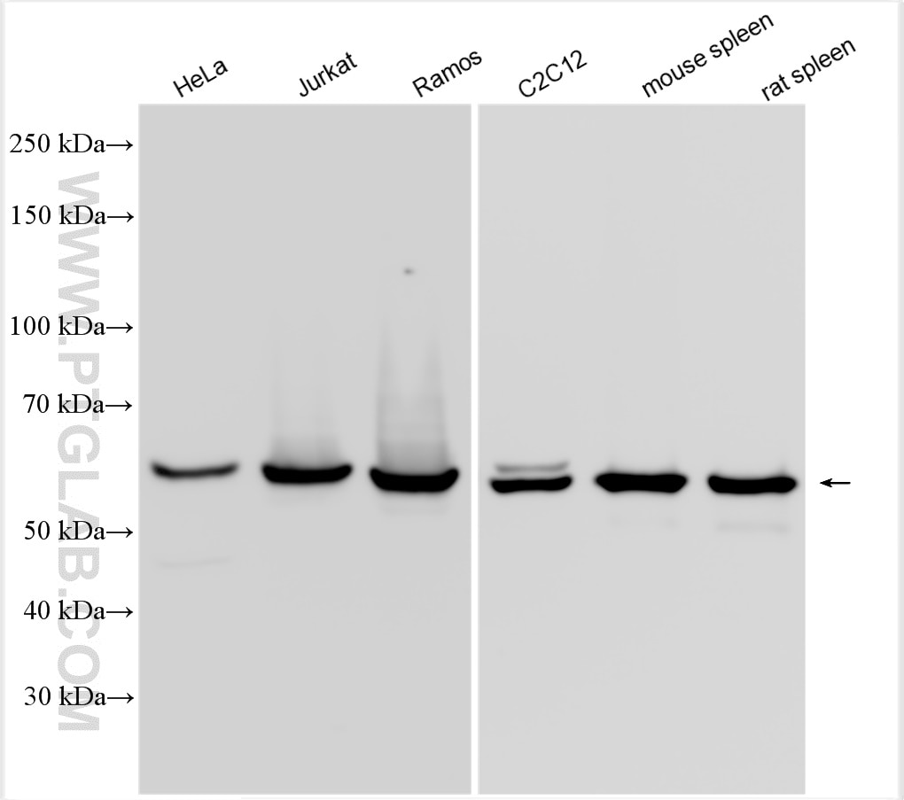 Western Blot (WB) analysis of various lysates using MST1 Polyclonal antibody (22245-1-AP)