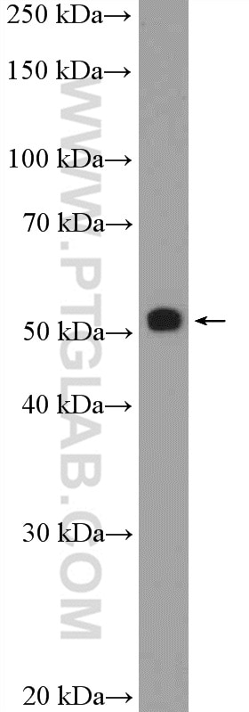 Western Blot (WB) analysis of rat liver tissue using MST1 Polyclonal antibody (22245-1-AP)