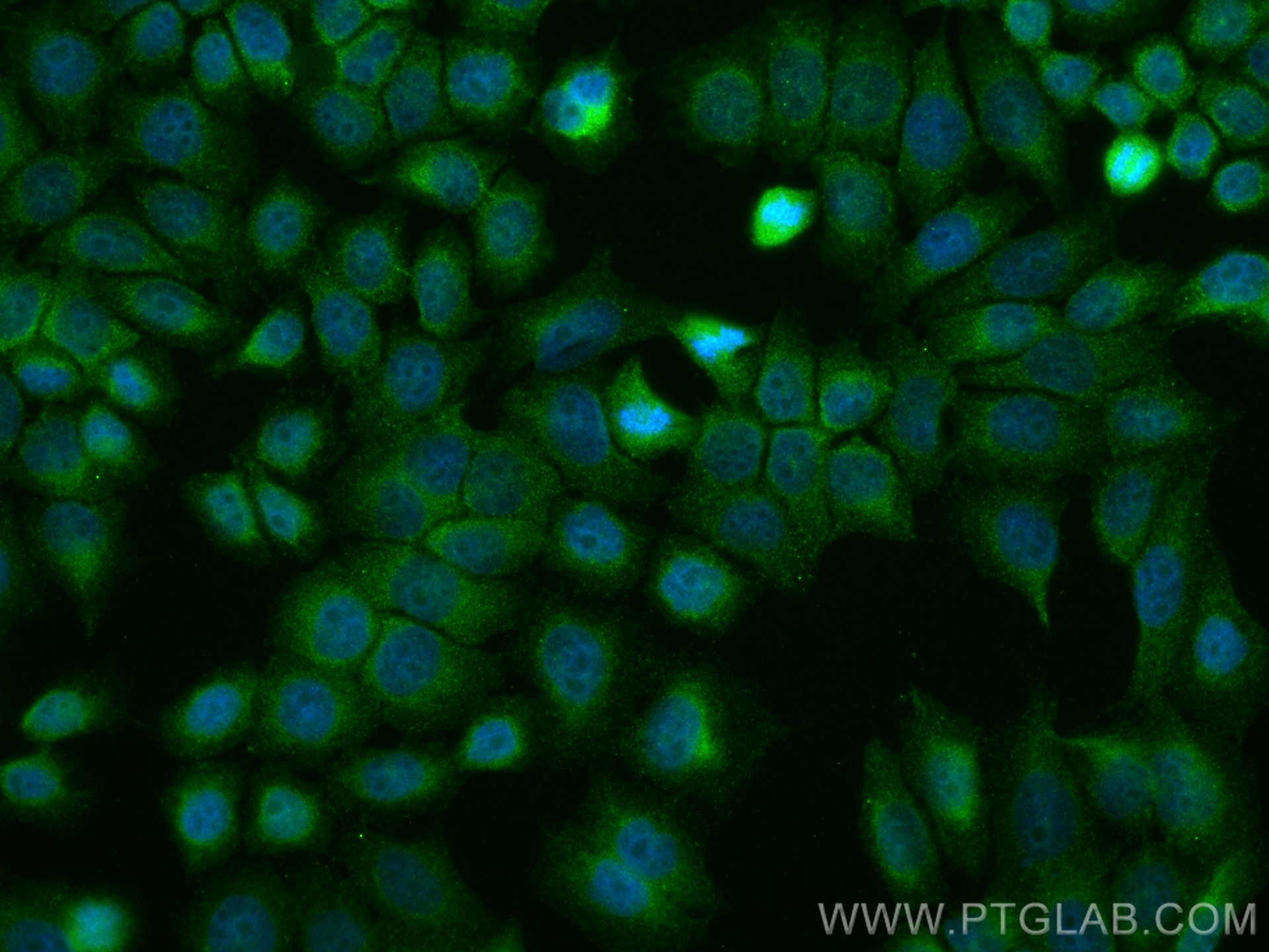 Immunofluorescence (IF) / fluorescent staining of PC-3 cells using MST1 Monoclonal antibody (66663-1-Ig)