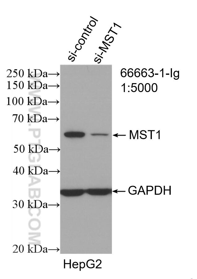 WB analysis of HepG2 using 66663-1-Ig