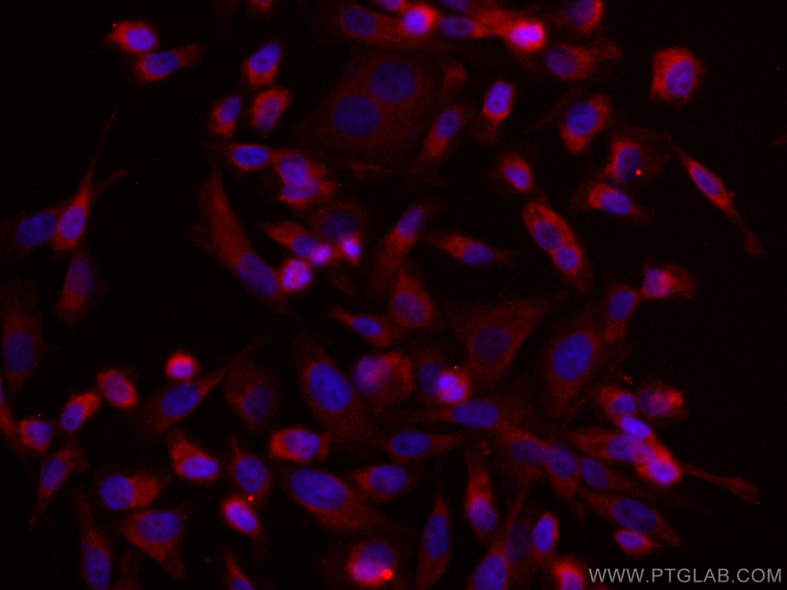 Immunofluorescence (IF) / fluorescent staining of PC-3 cells using CoraLite®594-conjugated MST1 Monoclonal antibody (CL594-66663)