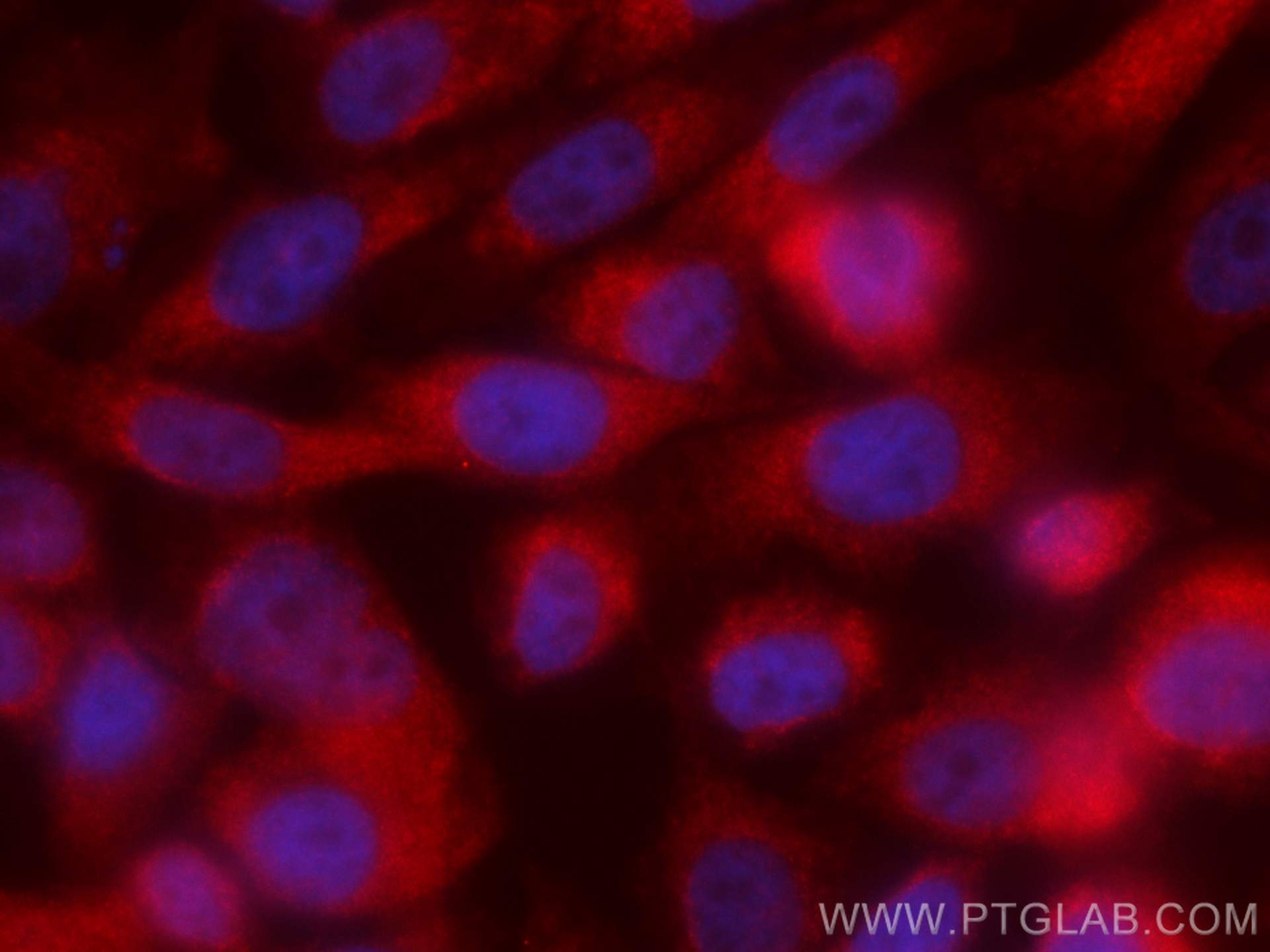 Immunofluorescence (IF) / fluorescent staining of PC-3 cells using CoraLite®594-conjugated STK4 Monoclonal antibody (CL594-66663)