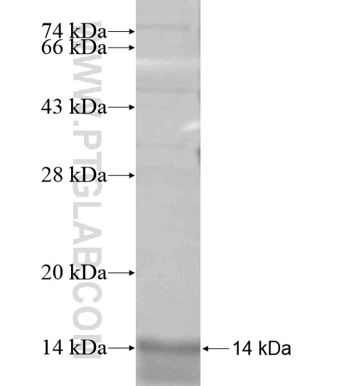 STK4 fusion protein Ag18761 SDS-PAGE