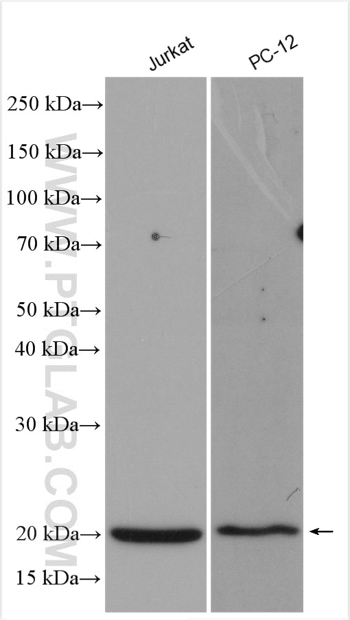 Western Blot (WB) analysis of various lysates using Stathmin 1 Polyclonal antibody (11157-1-AP)