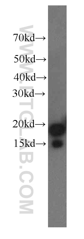 Western Blot (WB) analysis of human brain tissue using Stathmin 1 Monoclonal antibody (66090-1-Ig)