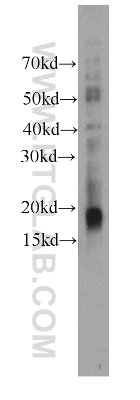 Western Blot (WB) analysis of K-562 cells using Stathmin 1 Monoclonal antibody (66090-1-Ig)