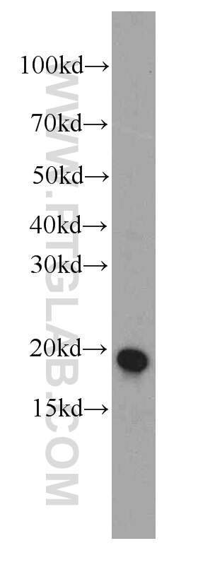 Western Blot (WB) analysis of Jurkat cells using Stathmin 1 Monoclonal antibody (66090-1-Ig)