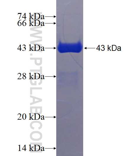 STMN1 fusion protein Ag1633 SDS-PAGE