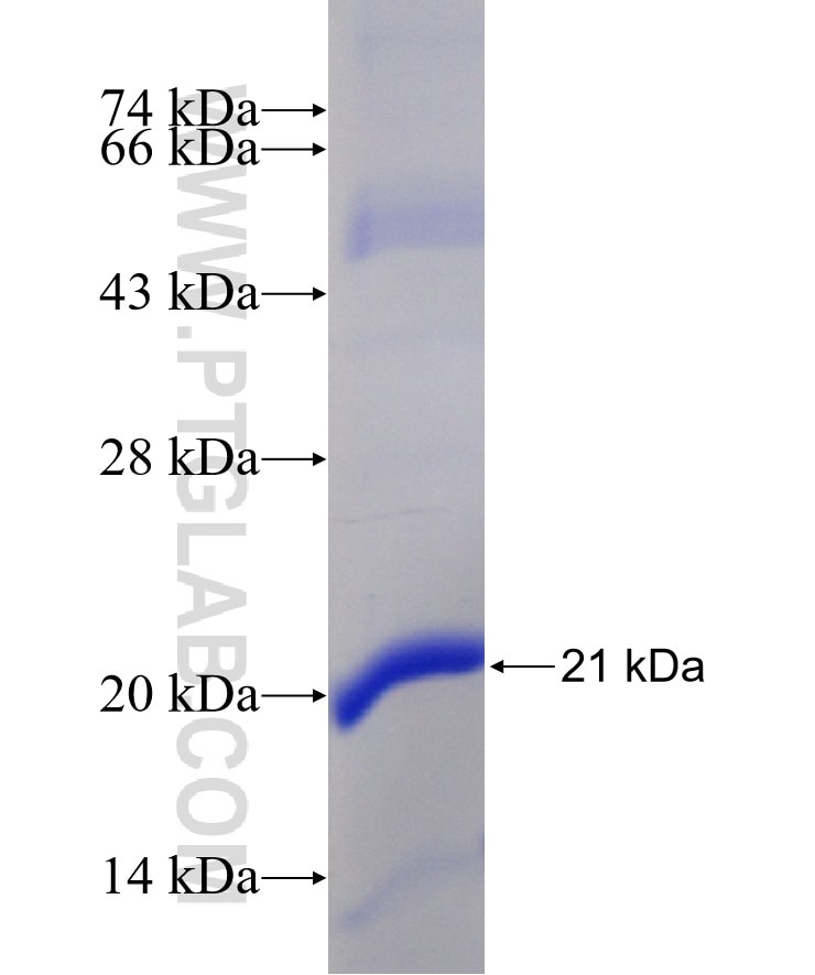 STMN1 fusion protein Ag19102 SDS-PAGE