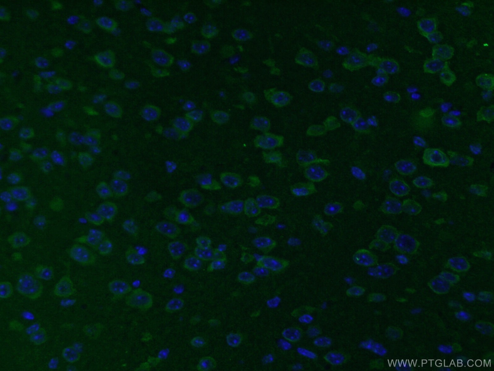 Immunofluorescence (IF) / fluorescent staining of mouse brain tissue using STMN2 Polyclonal antibody (10586-1-AP)