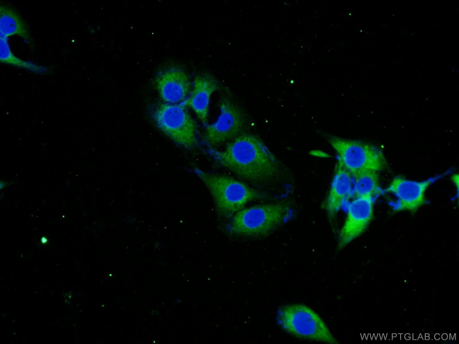 Immunofluorescence (IF) / fluorescent staining of SH-SY5Y cells using STMN2 Polyclonal antibody (10586-1-AP)