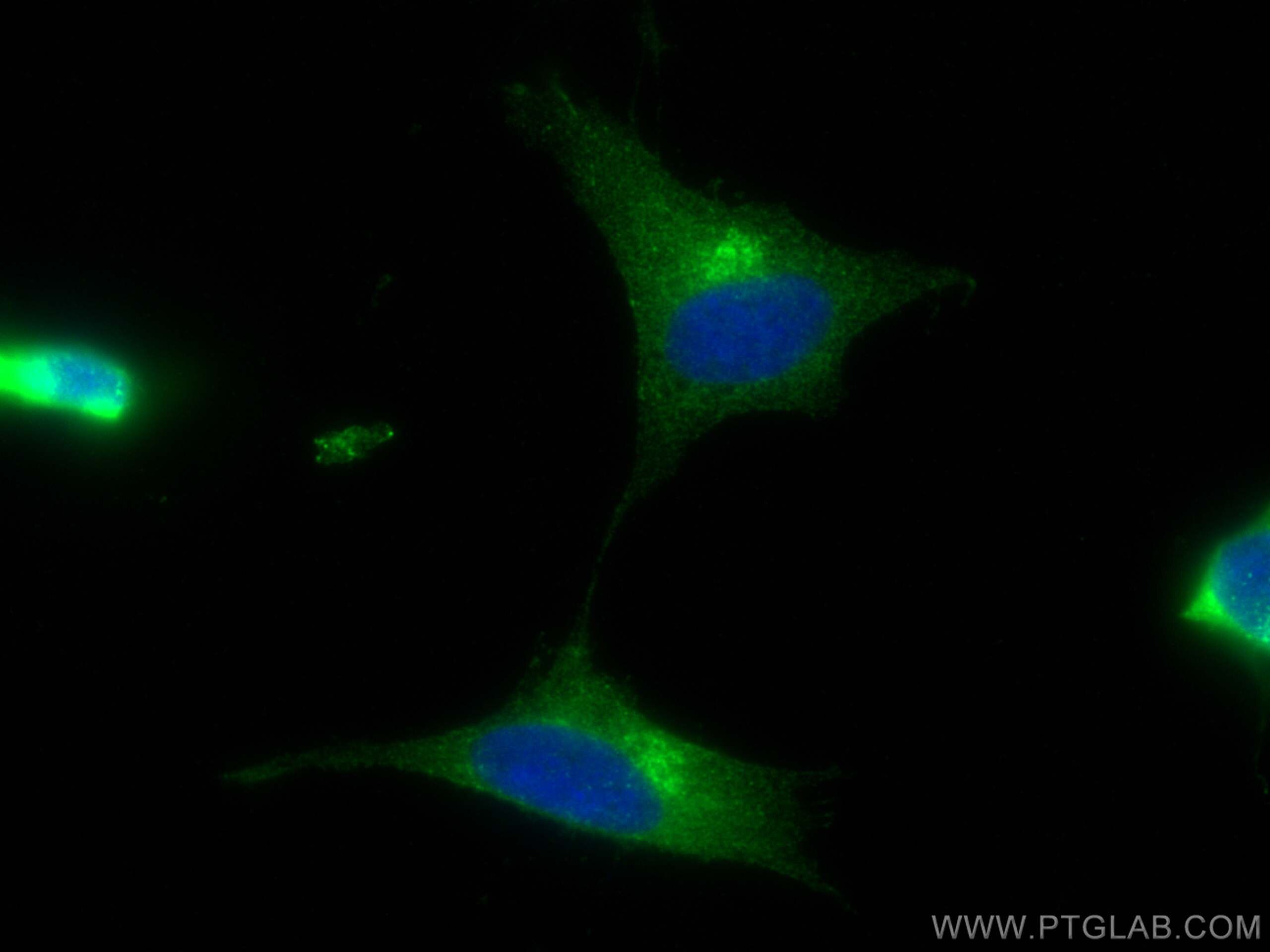 Immunofluorescence (IF) / fluorescent staining of SH-SY5Y cells using STMN2 Polyclonal antibody (10586-1-AP)