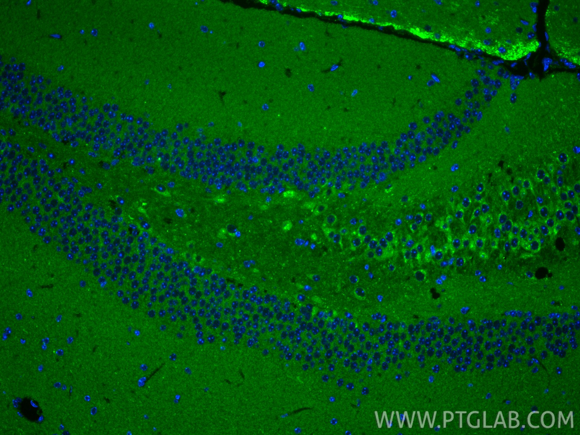 Immunofluorescence (IF) / fluorescent staining of mouse brain tissue using STMN2 Polyclonal antibody (10586-1-AP)