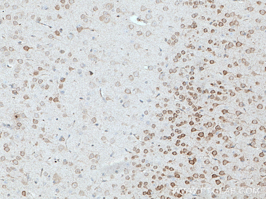Immunohistochemistry (IHC) staining of mouse brain tissue using STMN2 Polyclonal antibody (10586-1-AP)