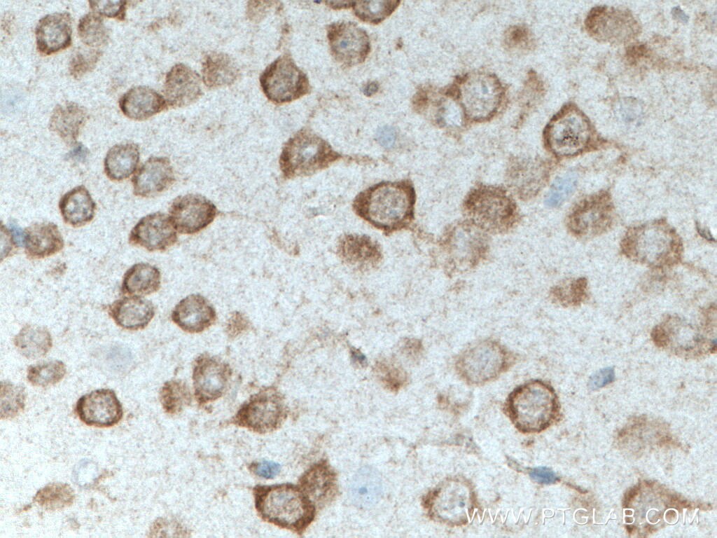 Immunohistochemistry (IHC) staining of mouse brain tissue using STMN2 Polyclonal antibody (10586-1-AP)
