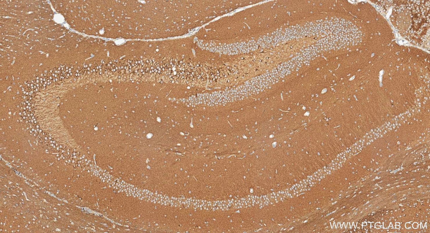 Immunohistochemistry (IHC) staining of mouse brain tissue using STMN2 Polyclonal antibody (10586-1-AP)