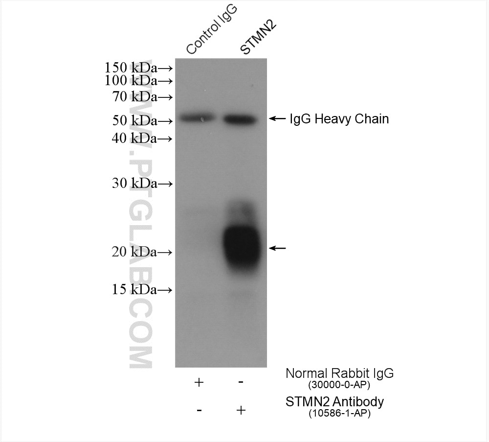 Immunoprecipitation (IP) experiment of mouse brain tissue using STMN2 Polyclonal antibody (10586-1-AP)