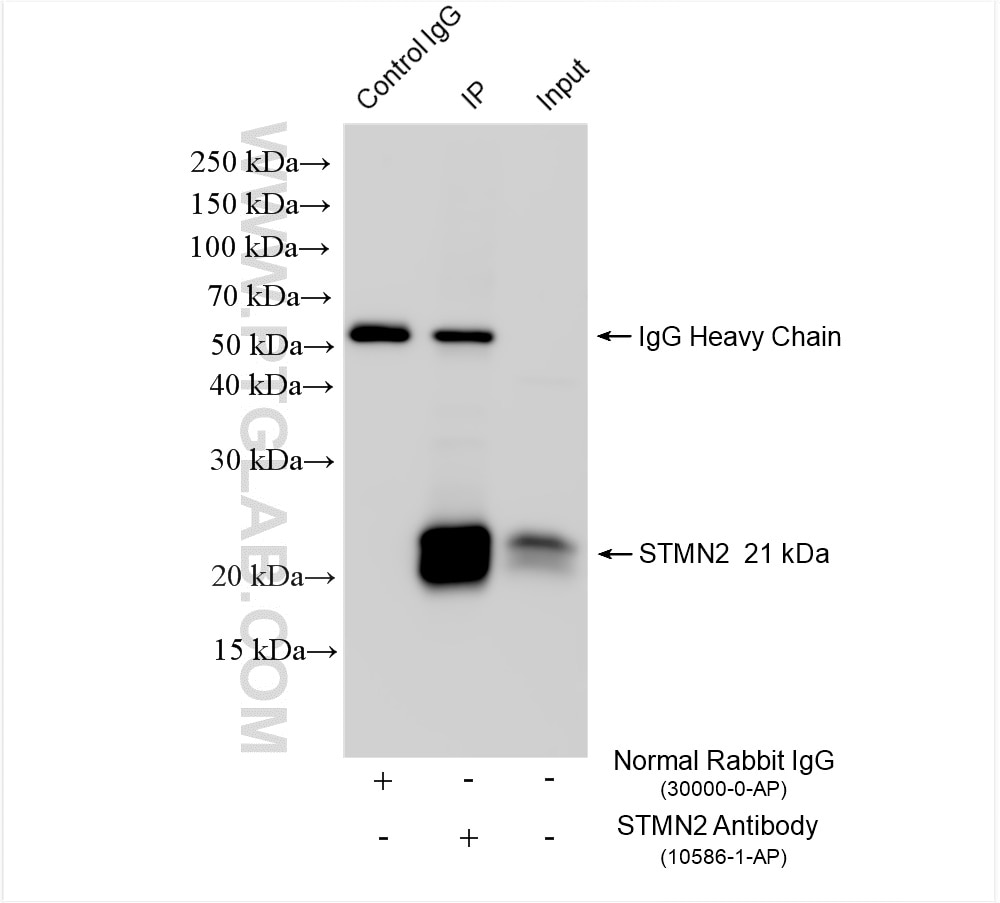 Immunoprecipitation (IP) experiment of mouse brain tissue using STMN2 Polyclonal antibody (10586-1-AP)