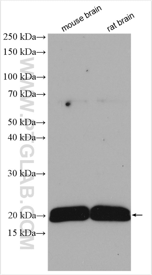 Western Blot (WB) analysis of various lysates using STMN2 Polyclonal antibody (10586-1-AP)
