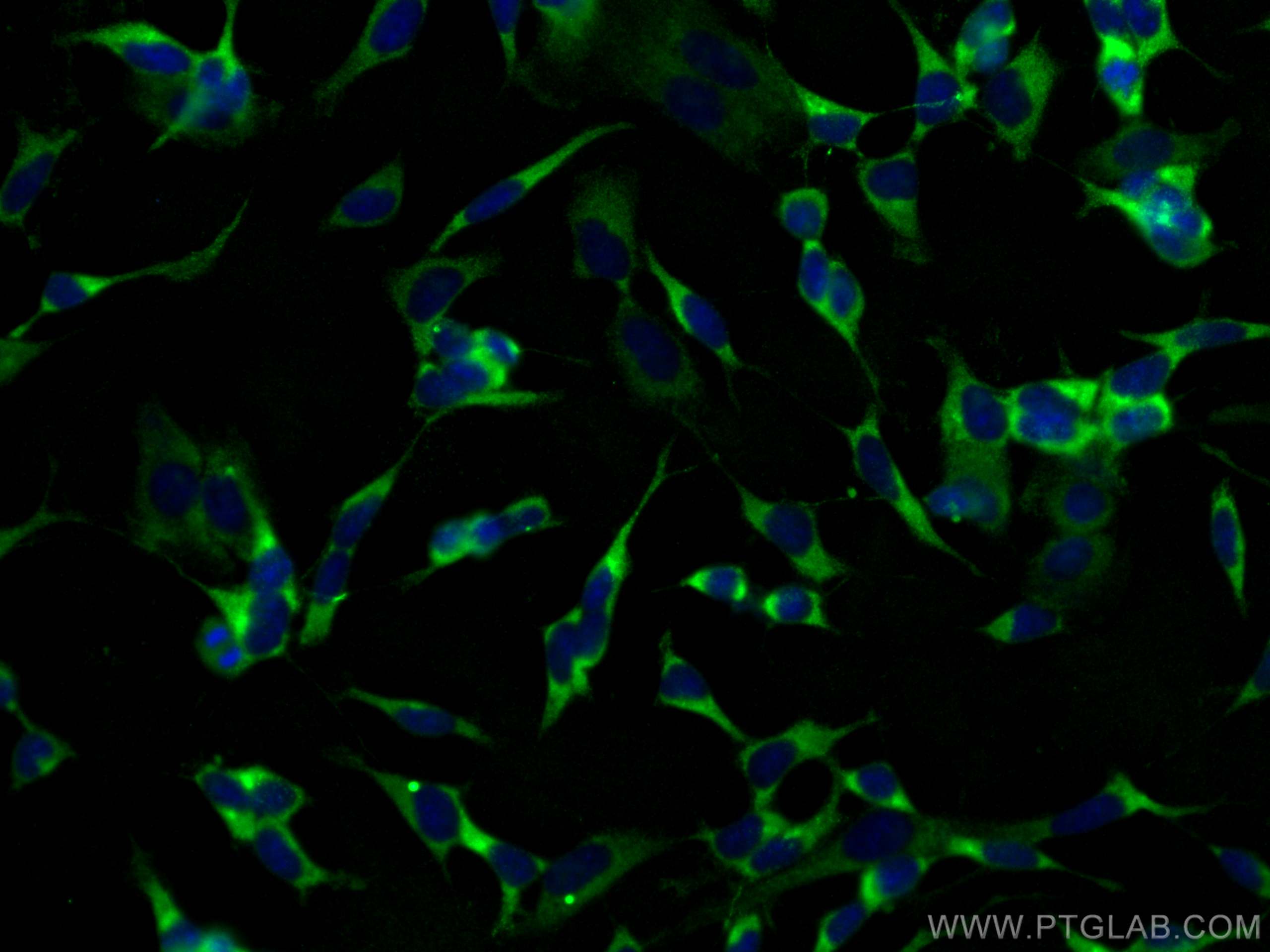Immunofluorescence (IF) / fluorescent staining of SH-SY5Y cells using STMN2 Monoclonal antibody (67204-1-Ig)