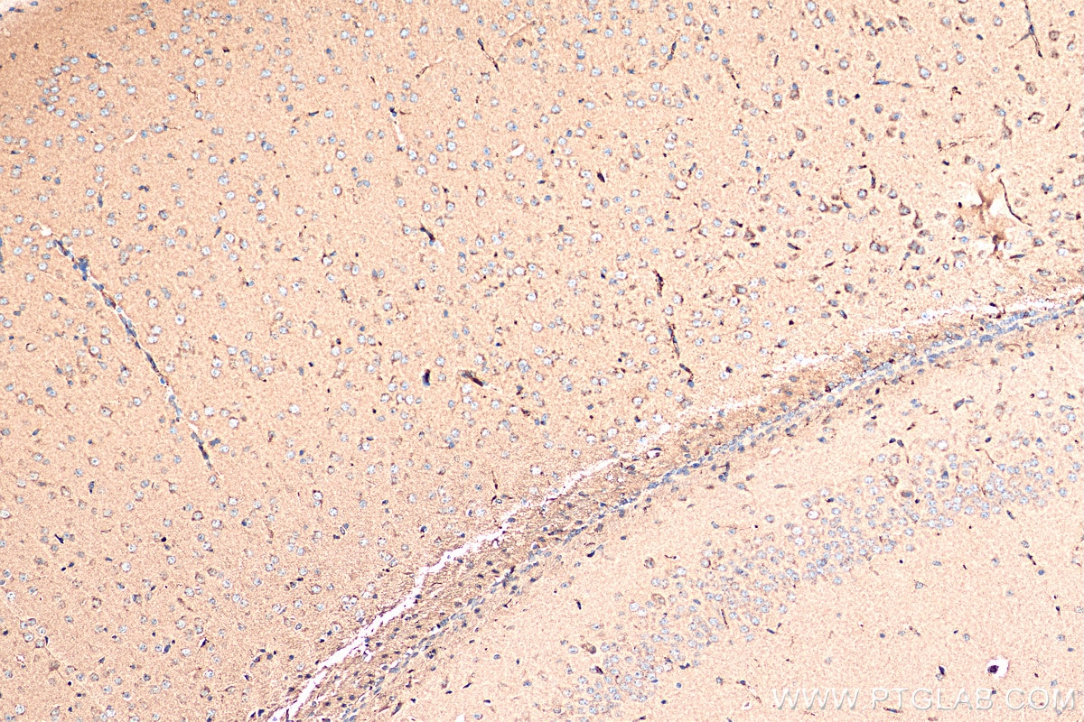 Immunohistochemistry (IHC) staining of mouse brain tissue using STMN2 Monoclonal antibody (67204-1-Ig)