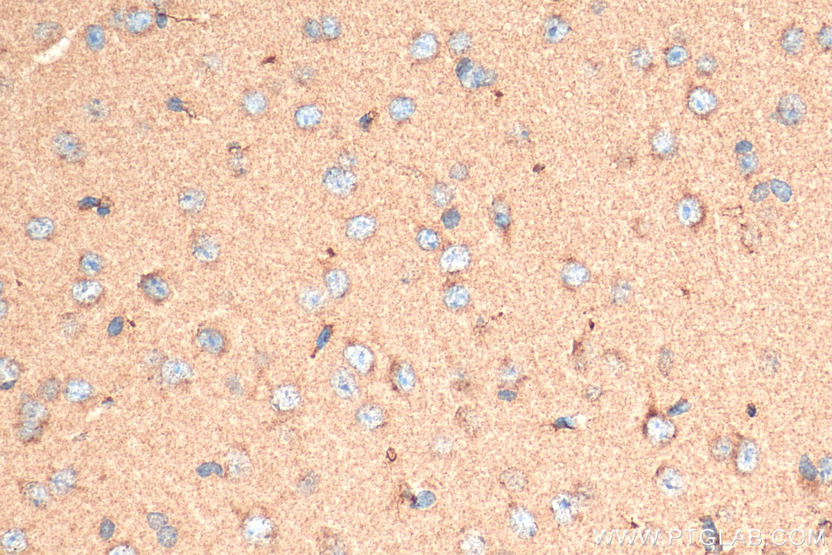 Immunohistochemistry (IHC) staining of mouse brain tissue using STMN2 Monoclonal antibody (67204-1-Ig)