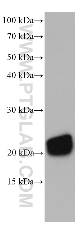 Western Blot (WB) analysis of fetal human brain tissue using STMN2 Monoclonal antibody (67204-1-Ig)