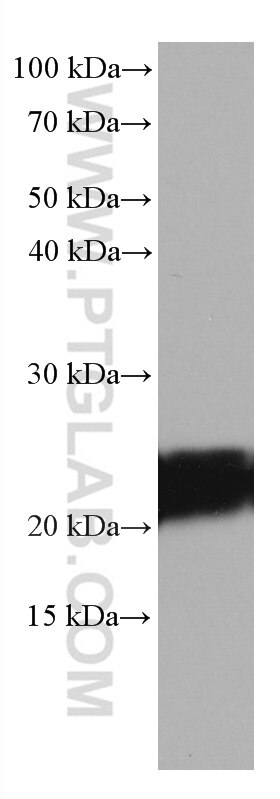 WB analysis of rat brain using 67204-1-Ig