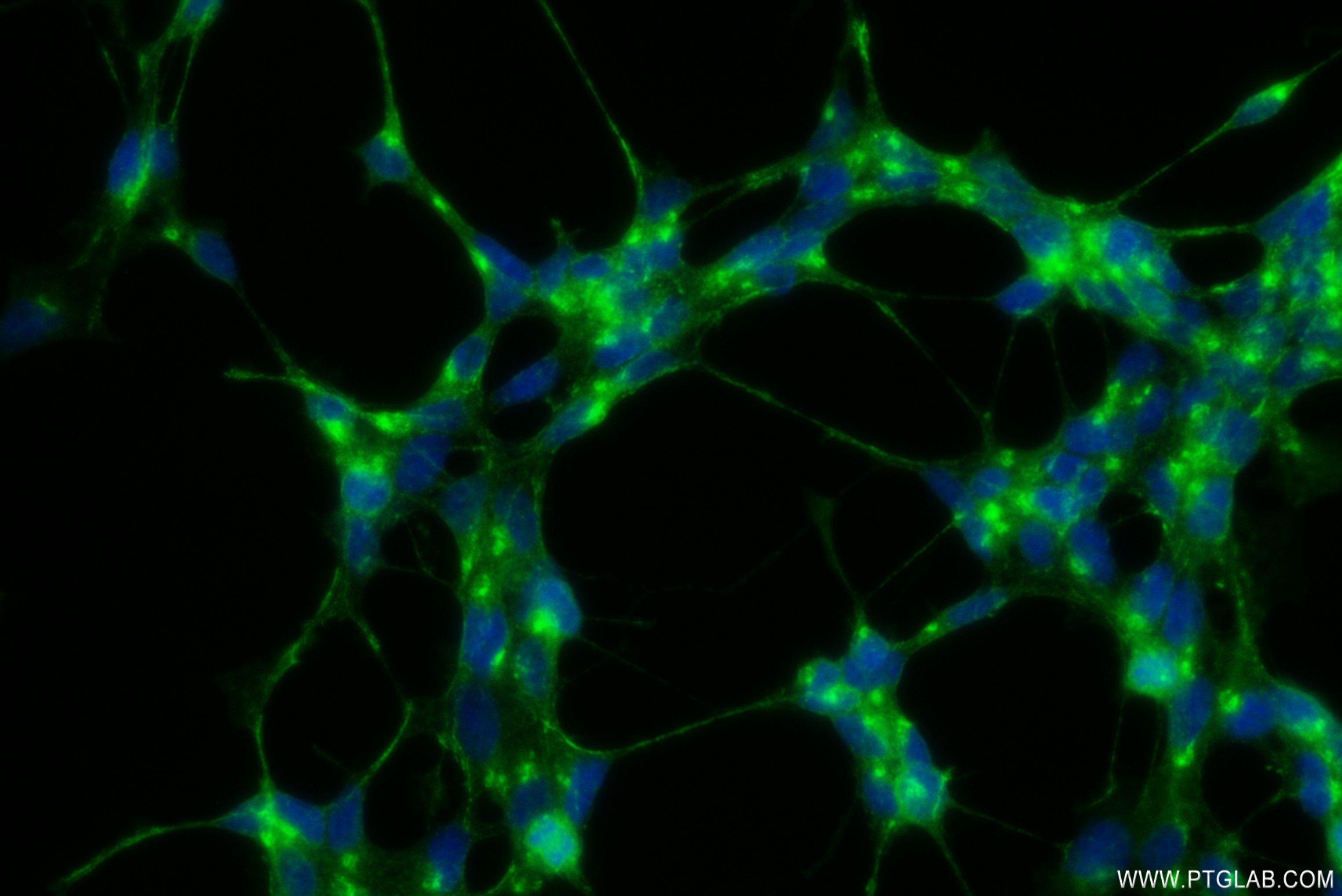 IF Staining of SH-SY5Y using 82925-1-RR