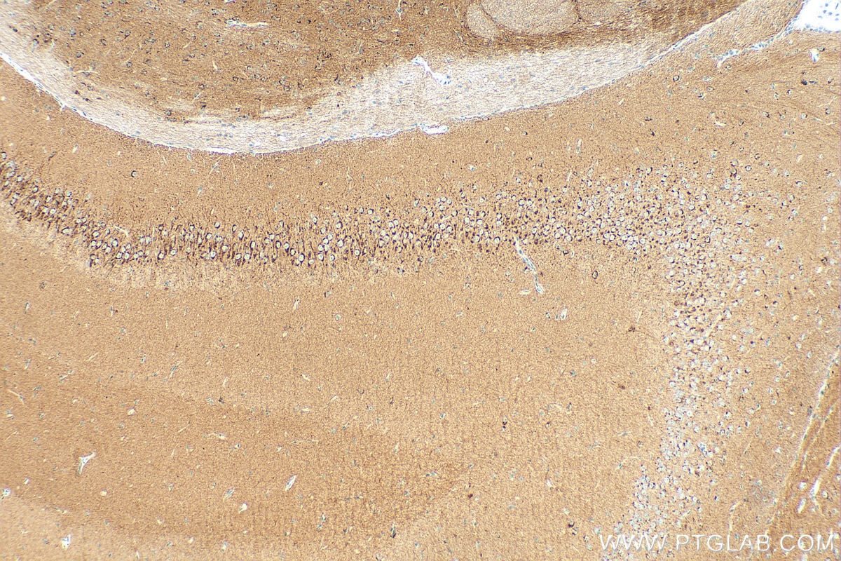 Immunohistochemistry (IHC) staining of mouse brain tissue using STMN2 Recombinant antibody (82925-1-RR)