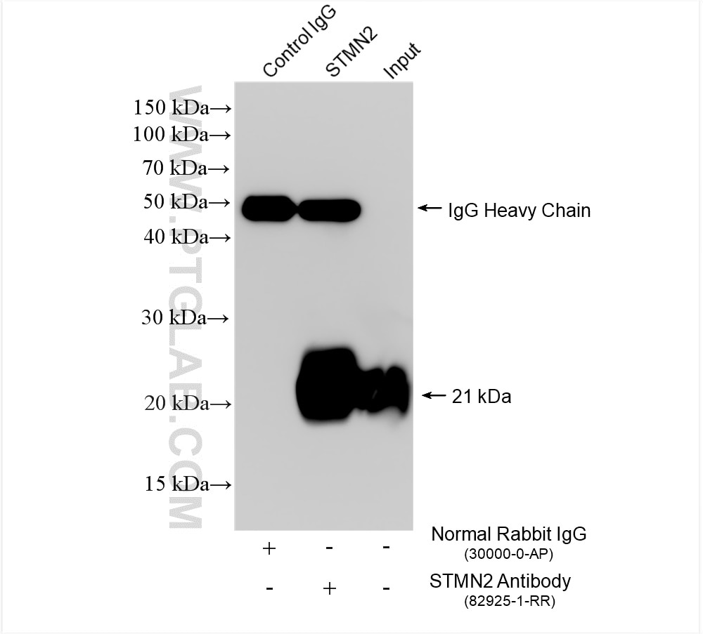 Immunoprecipitation (IP) experiment of mouse brain tissue using STMN2 Recombinant antibody (82925-1-RR)