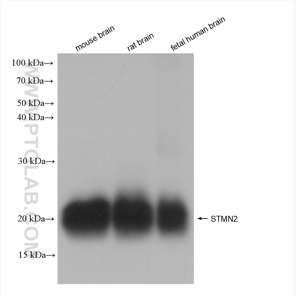 Western Blot (WB) analysis of various lysates using STMN2 Recombinant antibody (82925-1-RR)