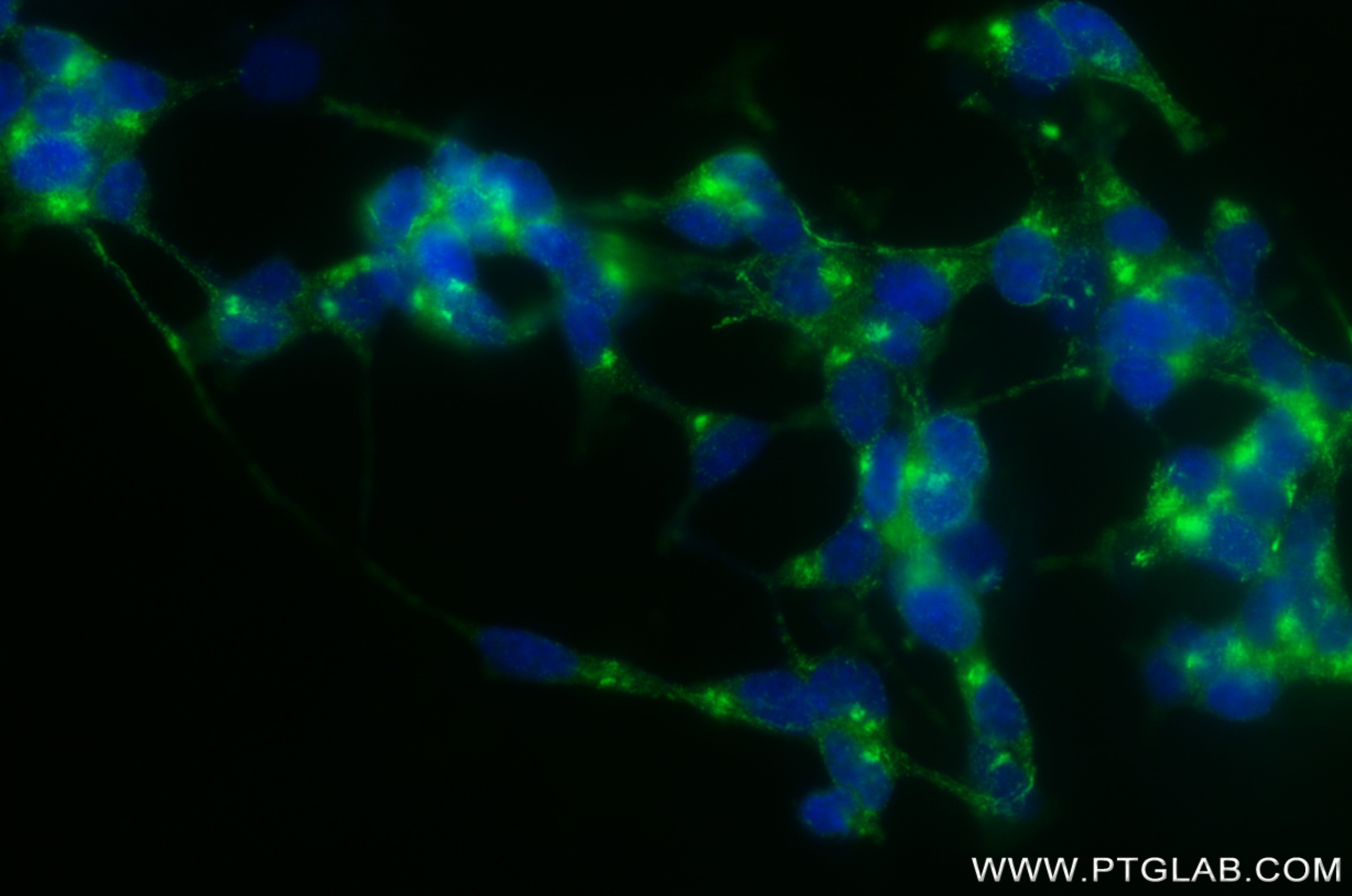 Immunofluorescence (IF) / fluorescent staining of SH-SY5Y cells using STMN2 Recombinant antibody (82925-2-RR)