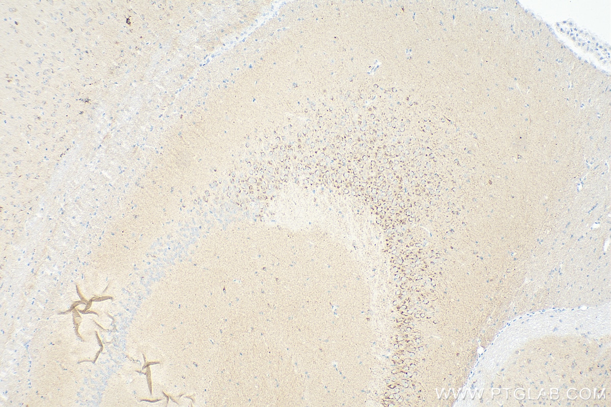 Immunohistochemistry (IHC) staining of mouse brain tissue using human STMN2 Recombinant antibody (82925-2-RR)