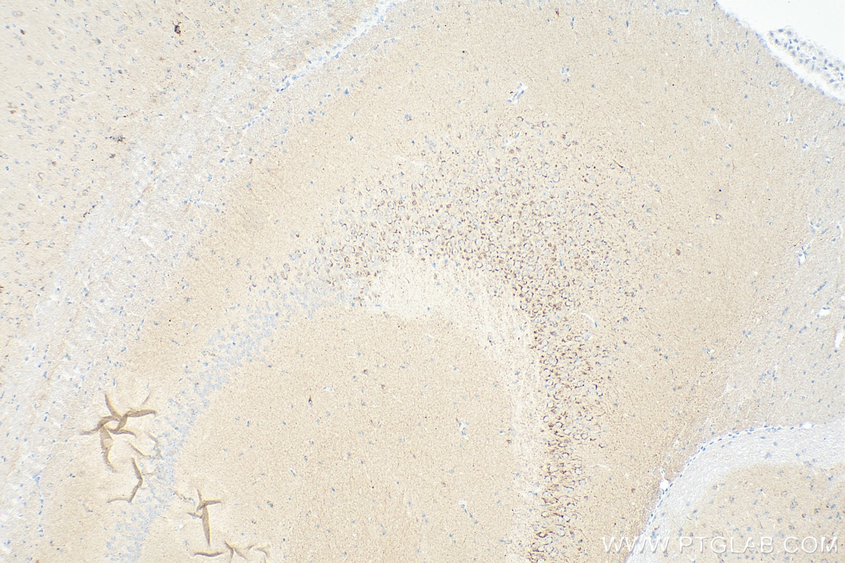 STMN2