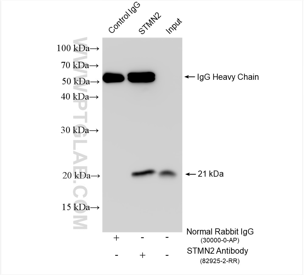 Immunoprecipitation (IP) experiment of SH-SY5Y cells using STMN2 Recombinant antibody (82925-2-RR)