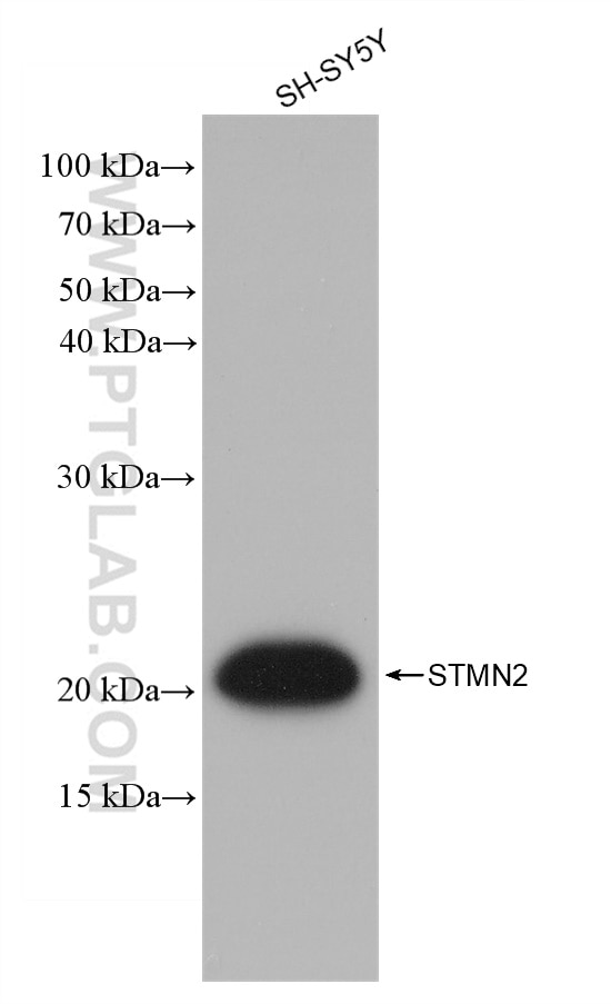 Western Blot (WB) analysis of SH-SY5Y cells using human STMN2 Recombinant antibody (82925-2-RR)