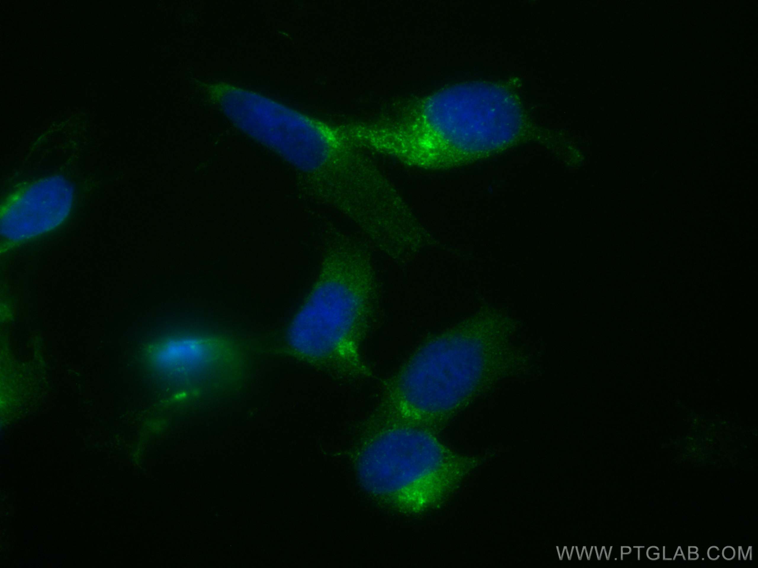 Immunofluorescence (IF) / fluorescent staining of SH-SY5Y cells using CoraLite® Plus 488-conjugated STMN2 Polyclonal ant (CL488-10586)